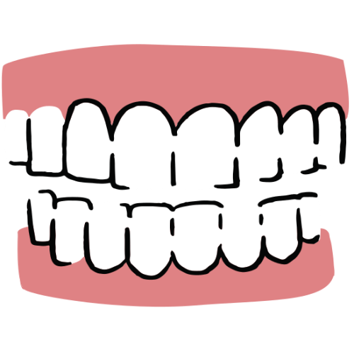 Dental Bridges