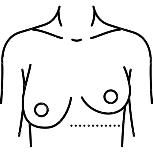 Breast Reduction
