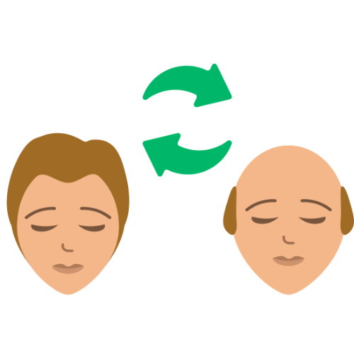 Tissue Expansion for Hair Restoration
