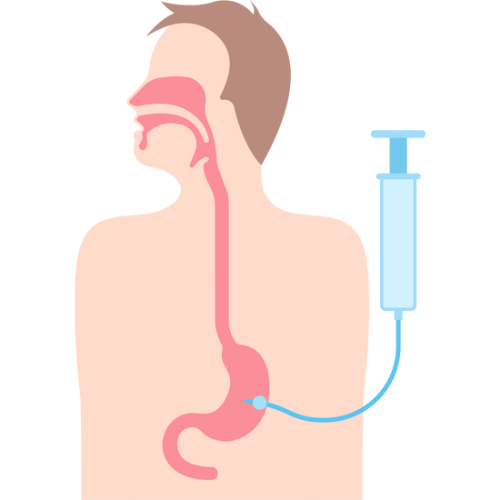 Vagus Nerve Block
