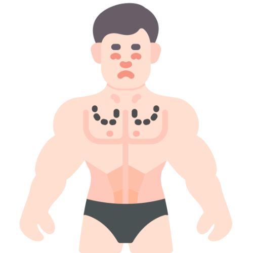 Male Breast Reduction
