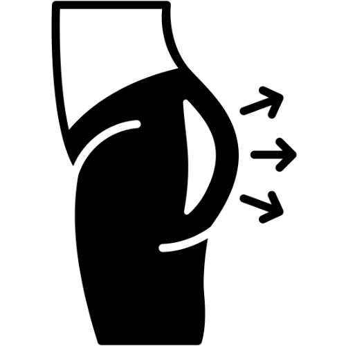 Gluteal Lift