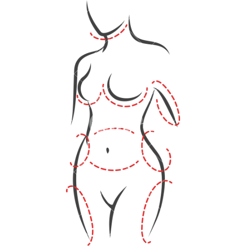Liposuction