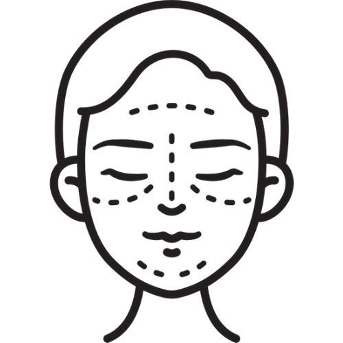 Facelift