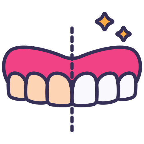 Teeth Whitening